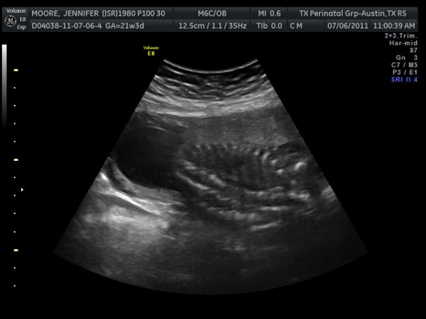 JAM4's Rib Bones and Spine